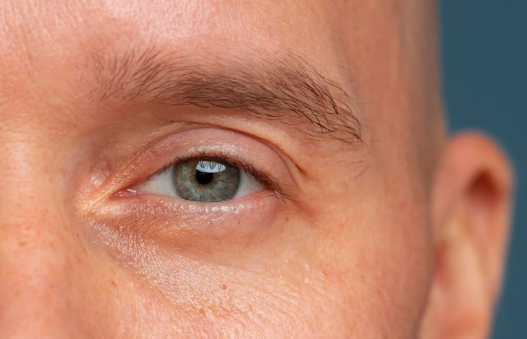 Coluna Oftalmologia Balcao News 13 8