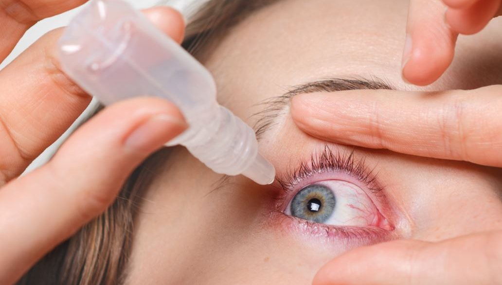 glaucoma